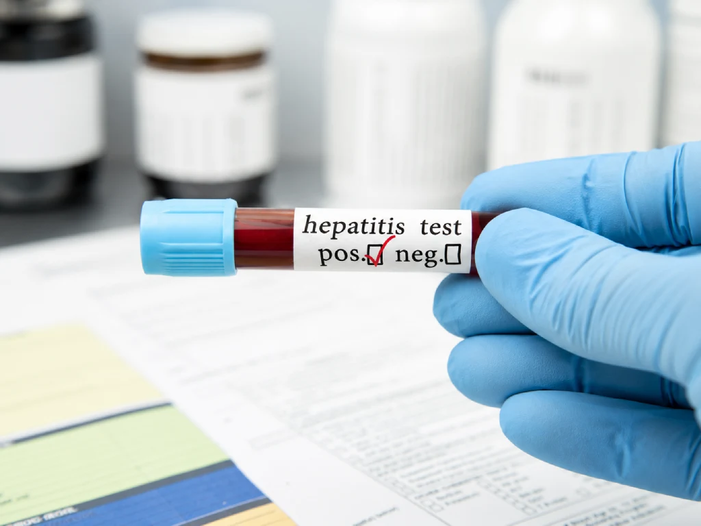 Hepatitis vaccination Singapore