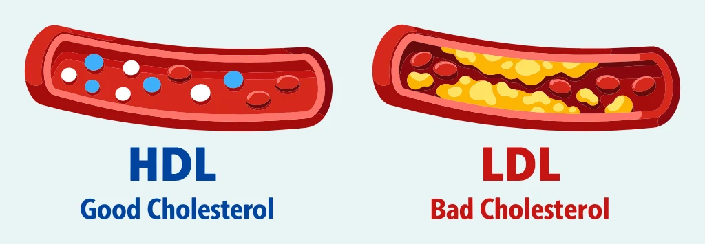 Good Cholesterol VS Bad Cholesterol