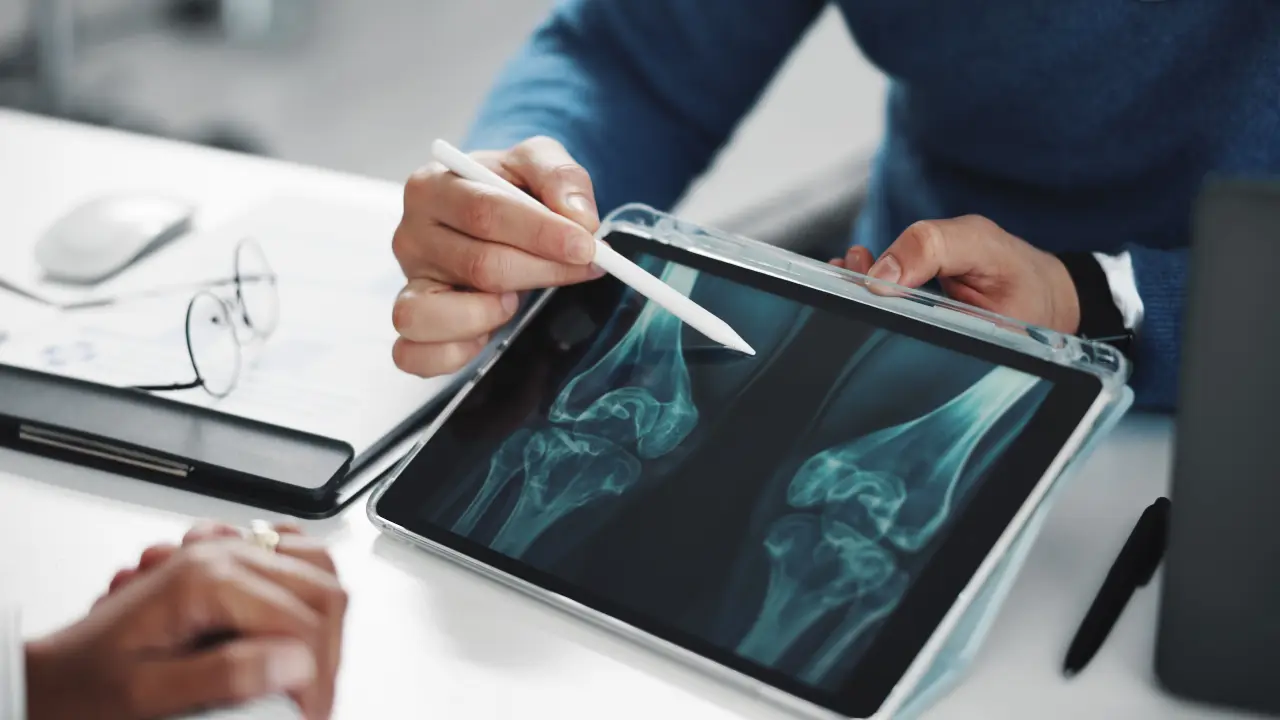 What To Do for Osteoarthritis