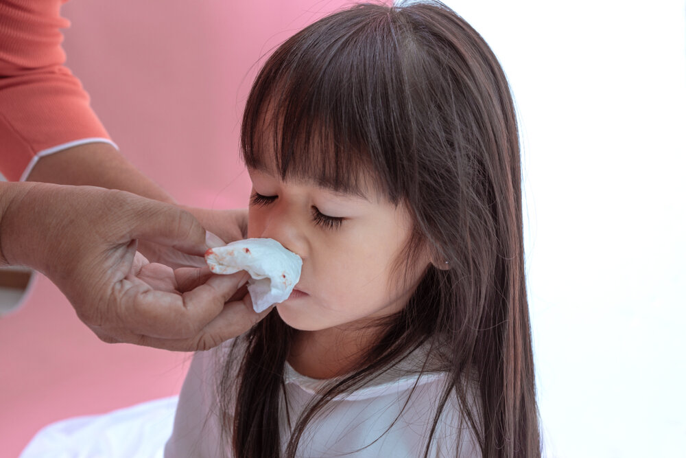 Nosebleeds in Children Paediatric Medicine Healthway Medical