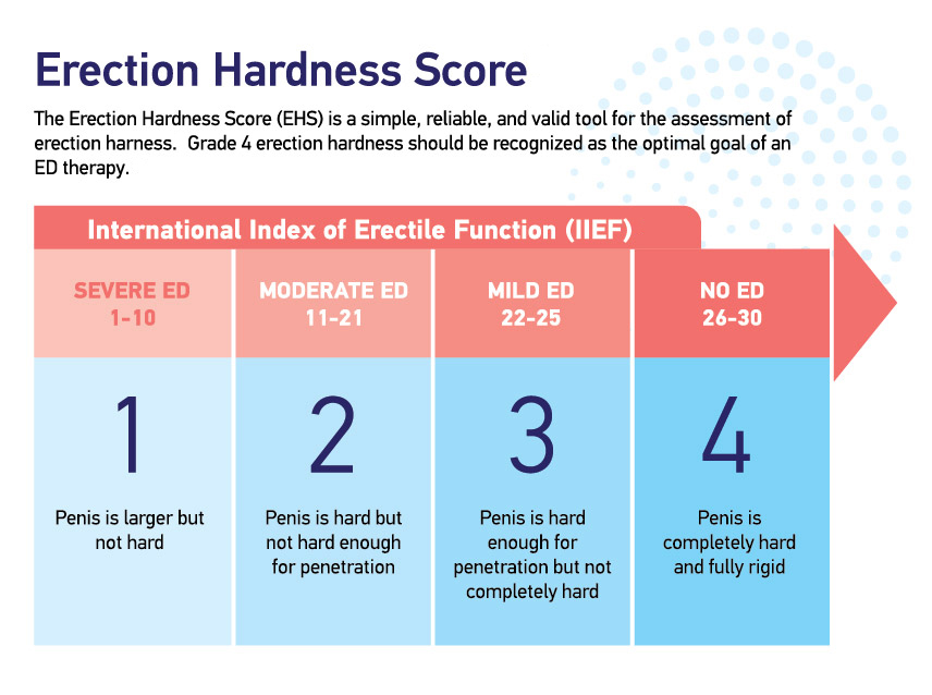 Erectile Dysfunction Causes Symptoms Methods Of Treatment