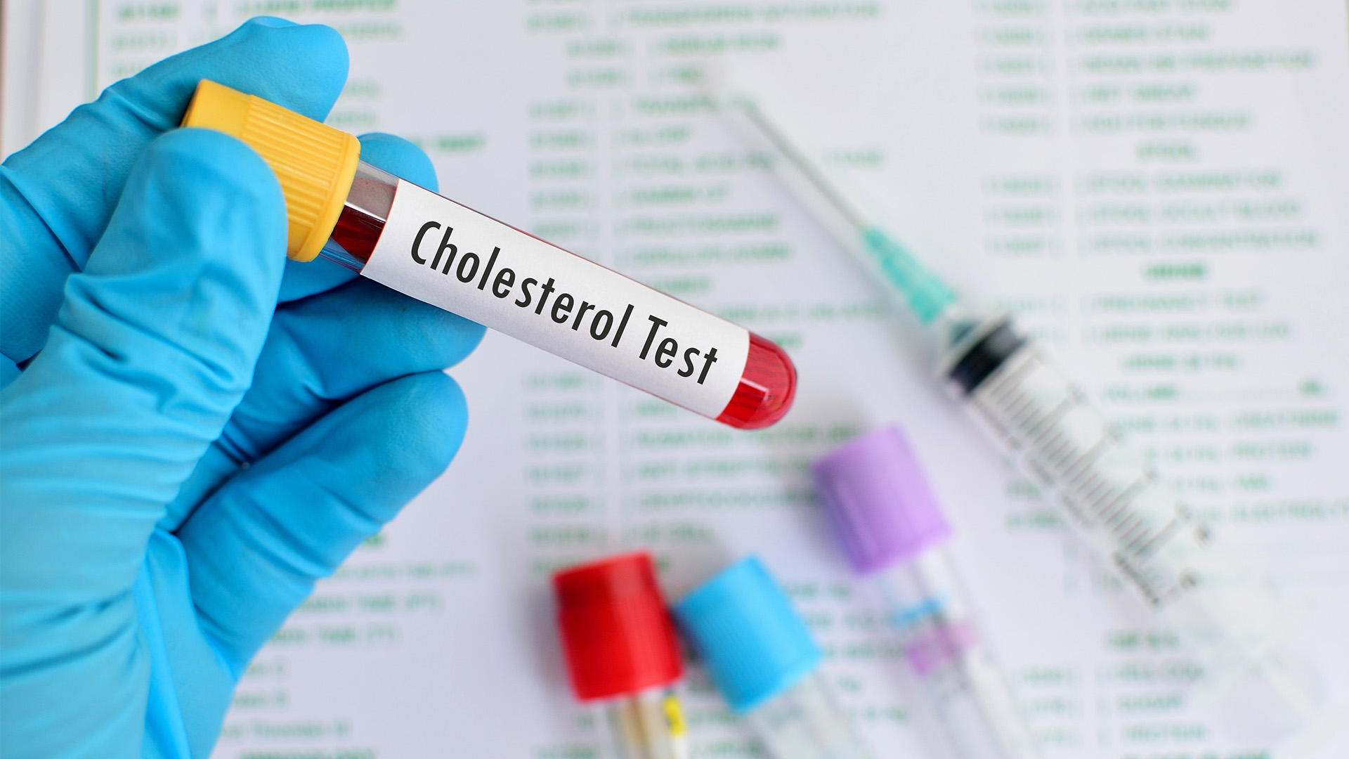 High Cholesterol - Healthway Medical GP clinics